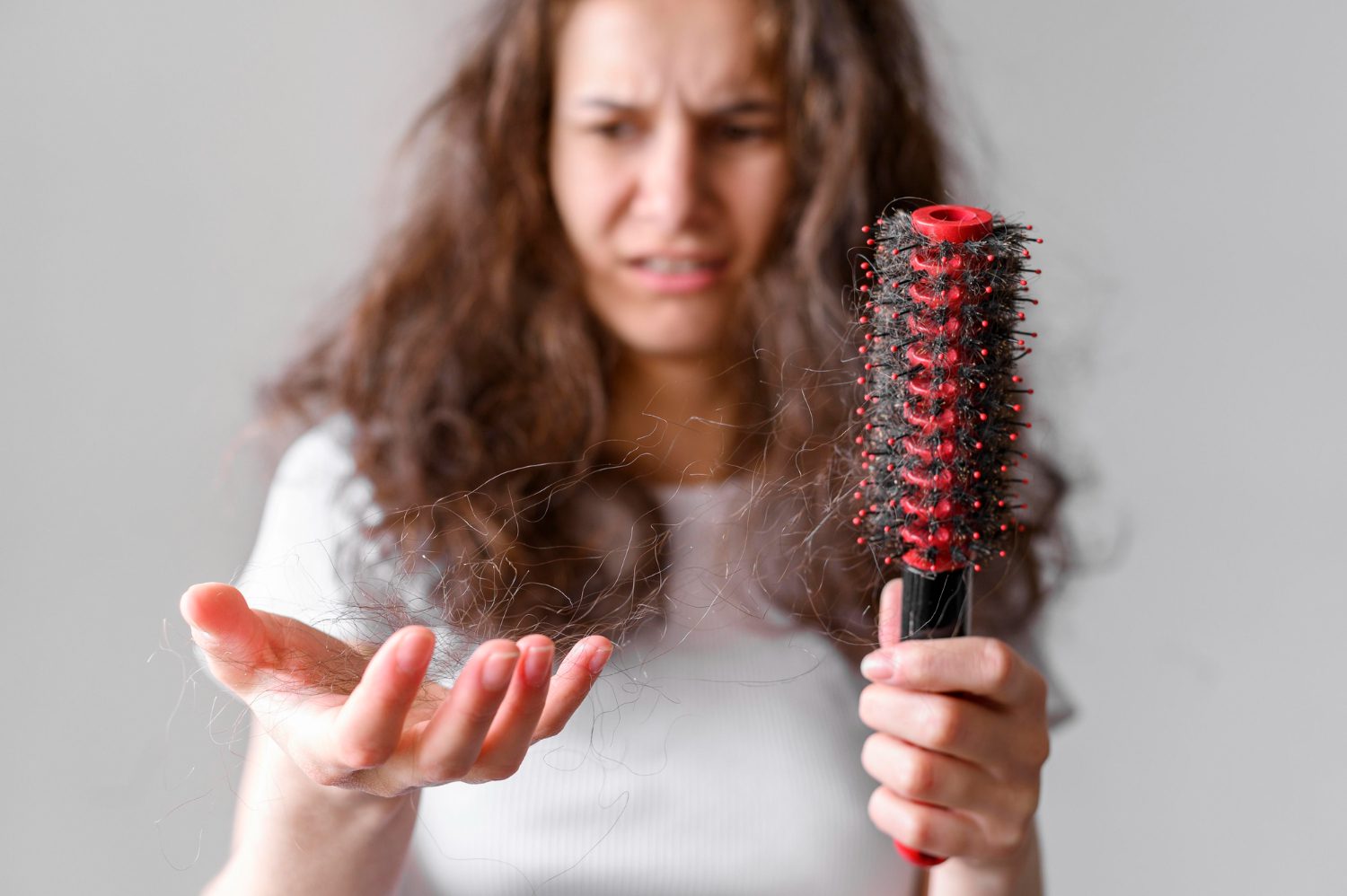 Hair Loss in Teenage Girl