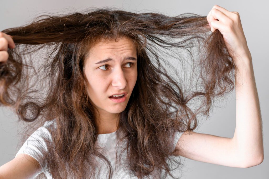 Hair Loss in Teenage Girl